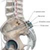 Thoracolumbar Products - Image 5